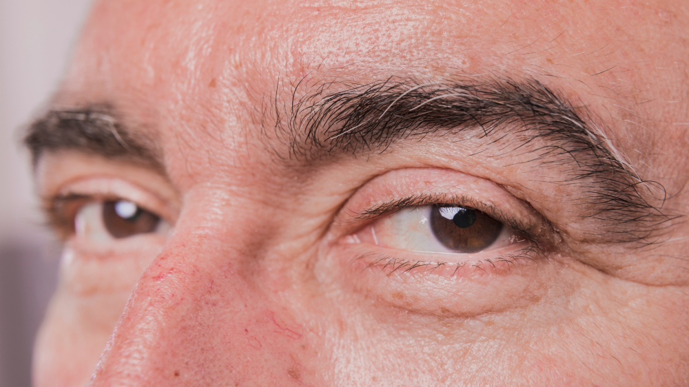 tratamento do glaucoma