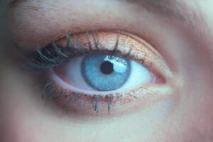 o glaucoma